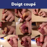 Simulation de doigt coupé