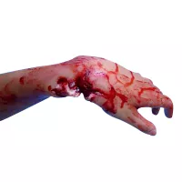 Simulation de fracture ouverte du poignet