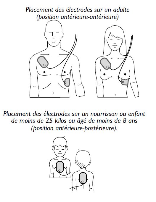 Electrodes
